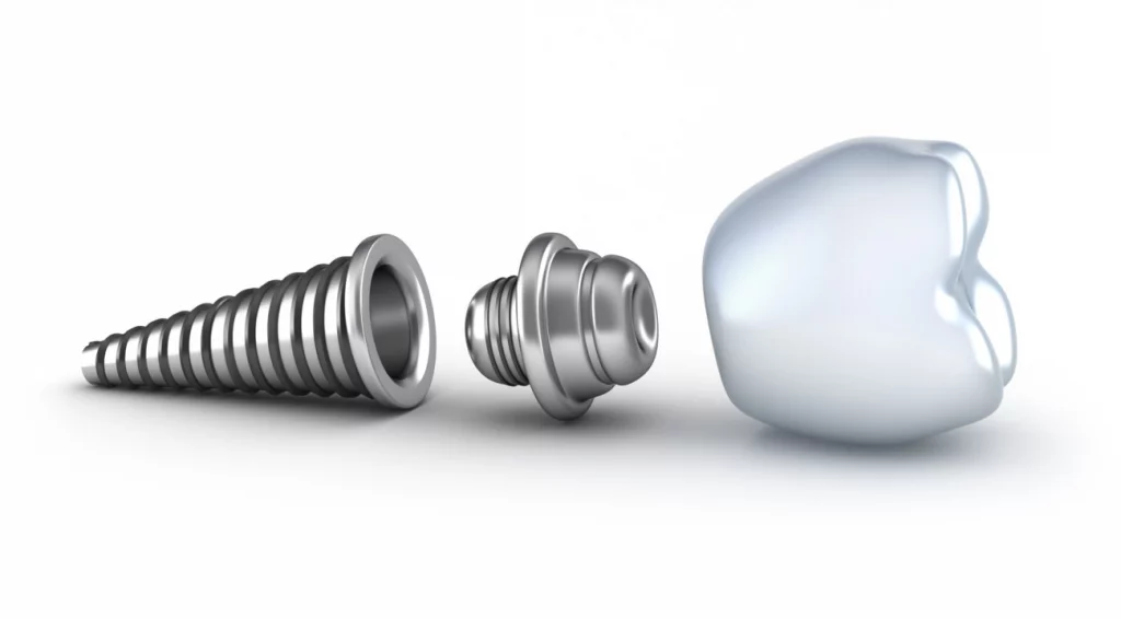 Single dental implant procedure in Virginia Beach