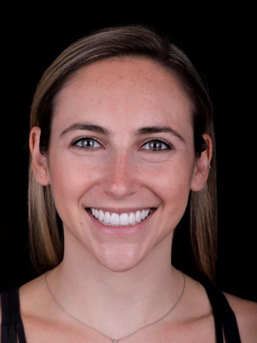 Results from dentistry at Coastal Cosmetic & Implant Dentistry
