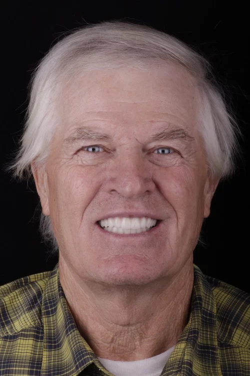 Results from dentistry at Coastal Cosmetic & Implant Dentistry
