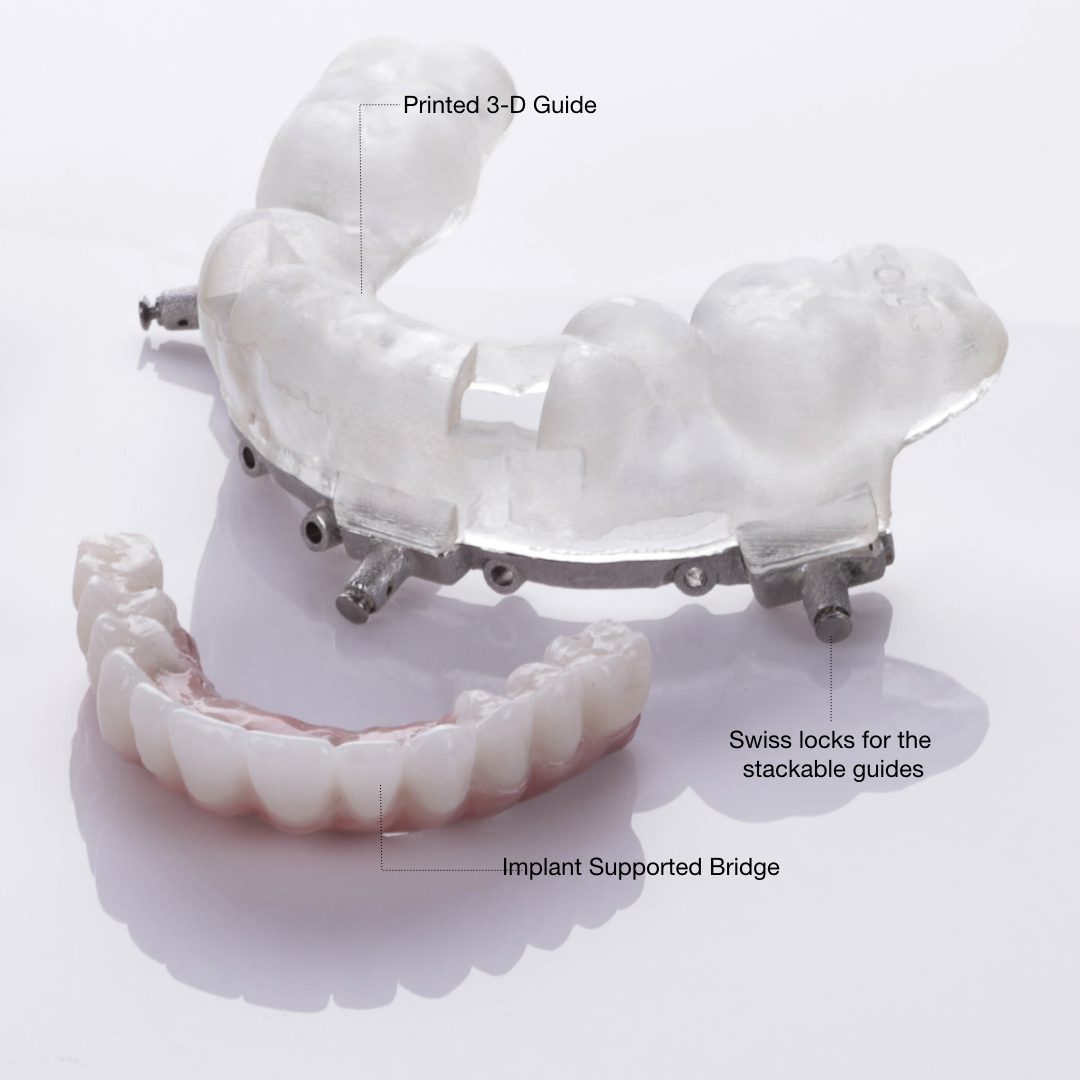 Teeth in a day in Virginia Beach