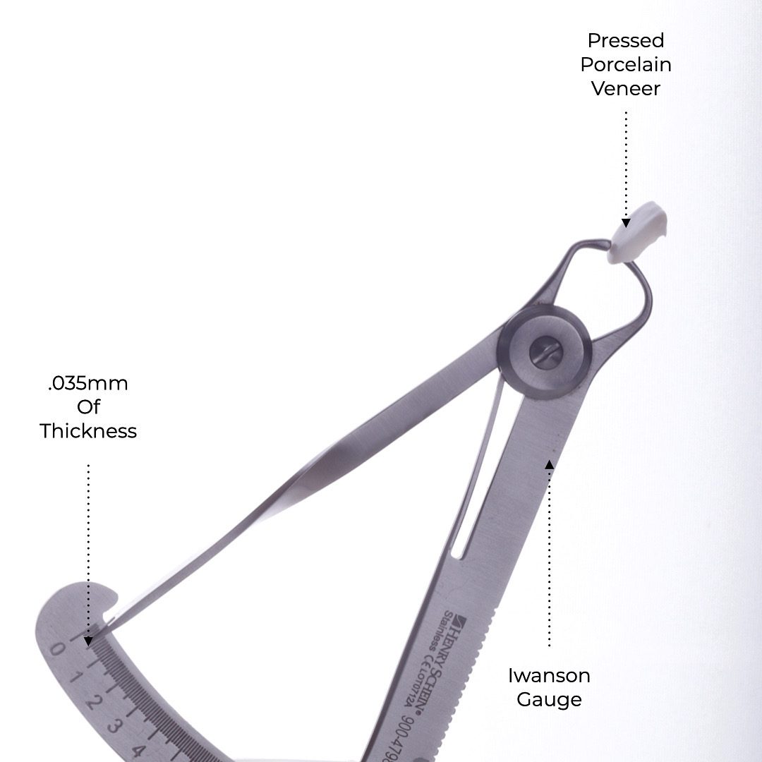 The precision fit of a porcelain veneer