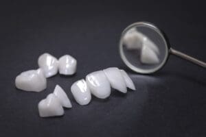 A sample of porcelain veneers