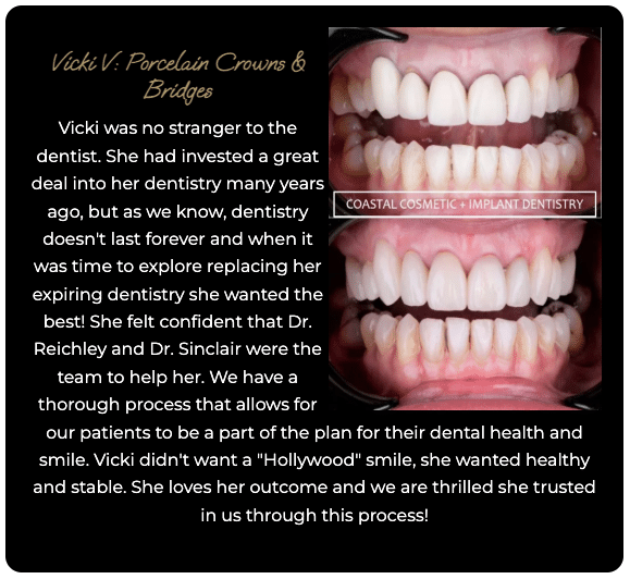 Bridges before and after case study
