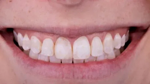 Before cosmetic dentistry